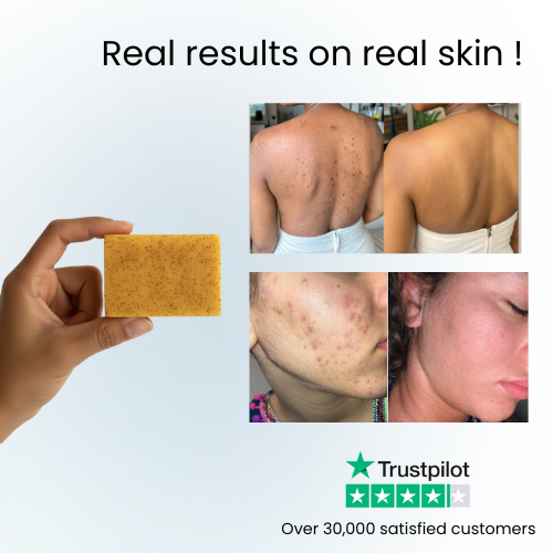 Tumeric soap